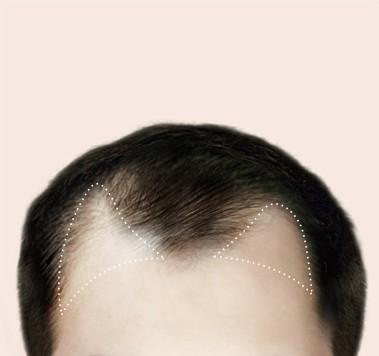 상담 및 정밀 분석