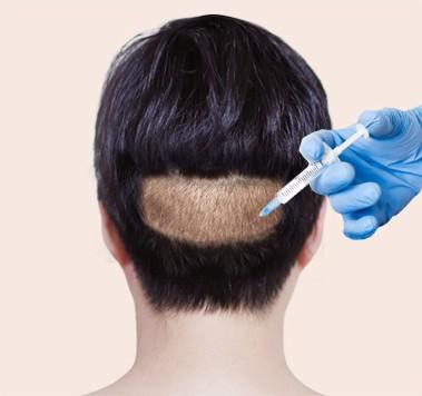 부분마취 또는 수면마취