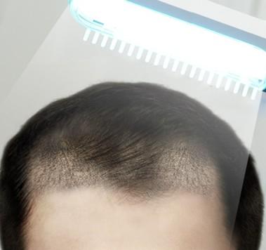 수술 후 케어