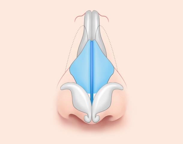 대칭