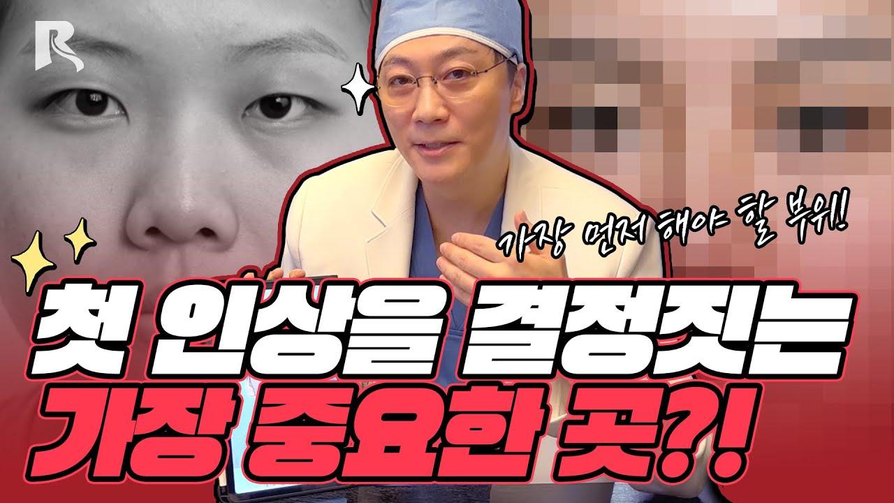눈성형과 첫인상 — 눈과 코 수술 중 하나만 한다면 무엇부터