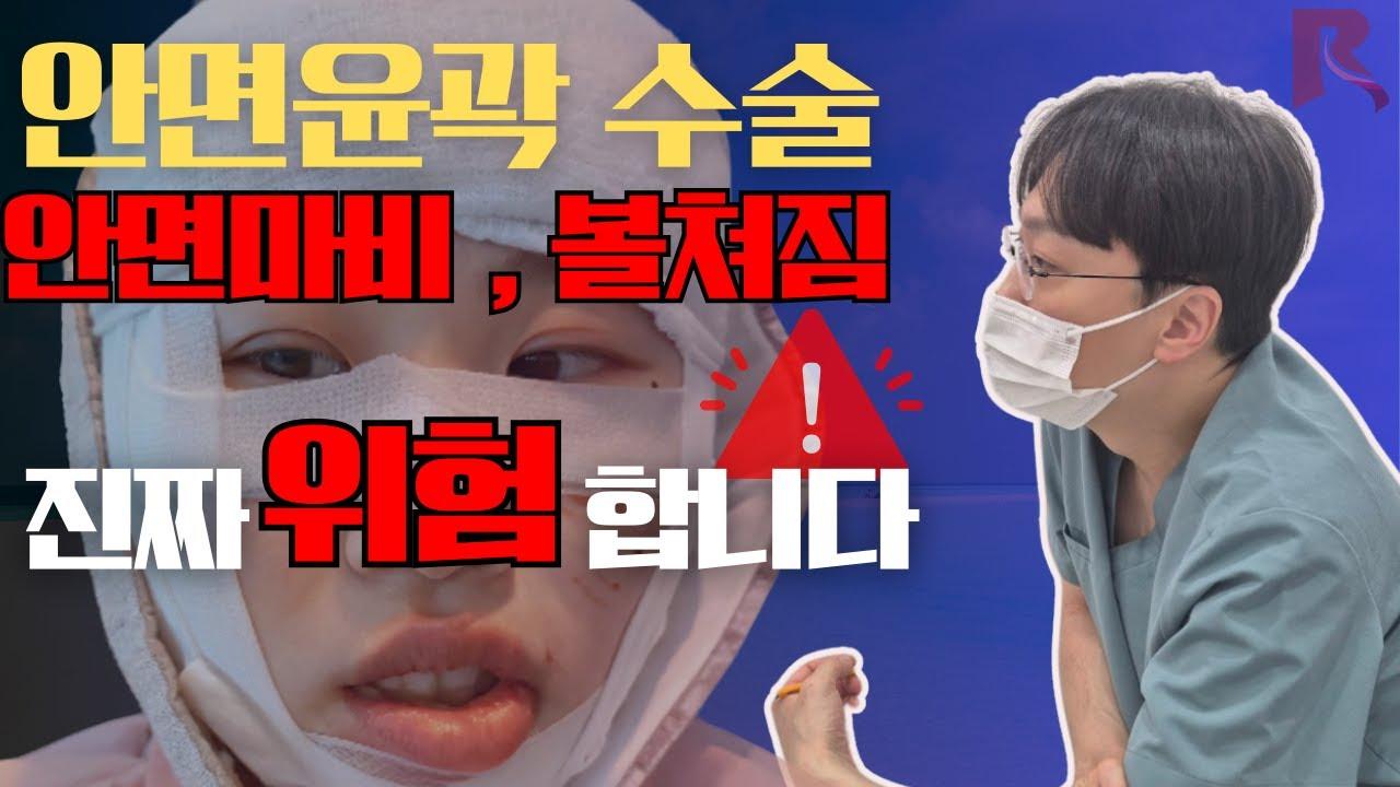 안면윤곽수술 후 안면마비와 볼처짐, 회복 가능할까