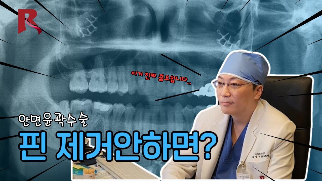 안면윤곽 핀제거 필요성과 윤곽수술 후 자주 묻는 질문